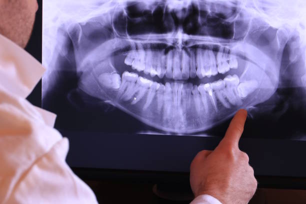 Best Emergency Care for Gum Disease in Magee, MS